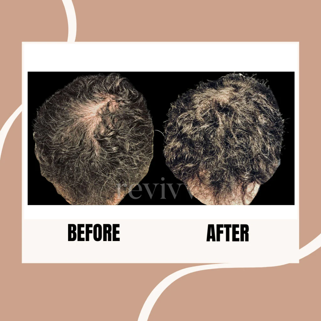 revivv-before-and-after-1024x1024.jpg